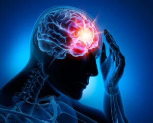 Memory Loss After a Concussion